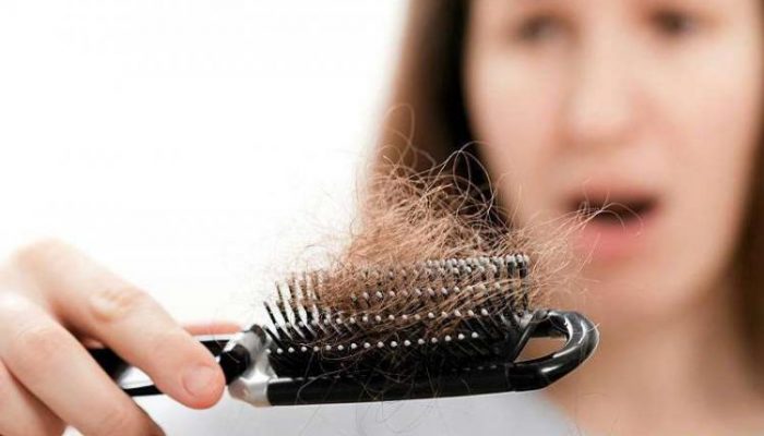 Диффузное телогеновое выпадение волос у женщин