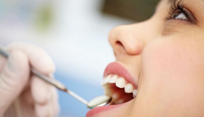 Почему возникает красный плоский лишай в полости рта? Симптомы, причины и тактика лечения