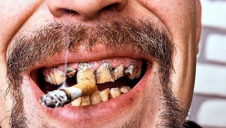 Рак губы от курения