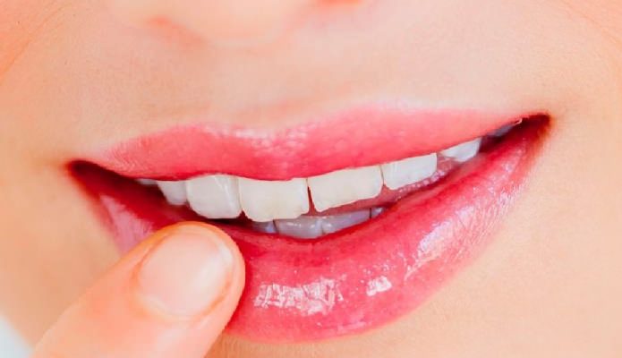 Почему сильно трескаются губы? Причины и лечение распространенной проблемы