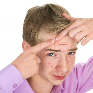 5 советов для мальчиков-подростков, которые борются с угревой сыпью