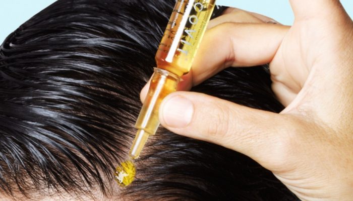 Витамины для волос от выпадения в ампулах