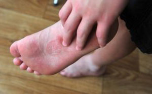 Почему чешутся ступни ног и какие причины зуда кожи