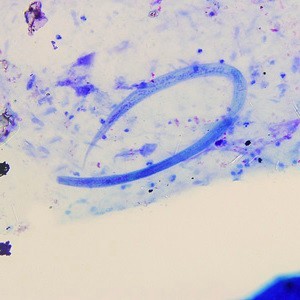 Кишечная угрица под микроскопом