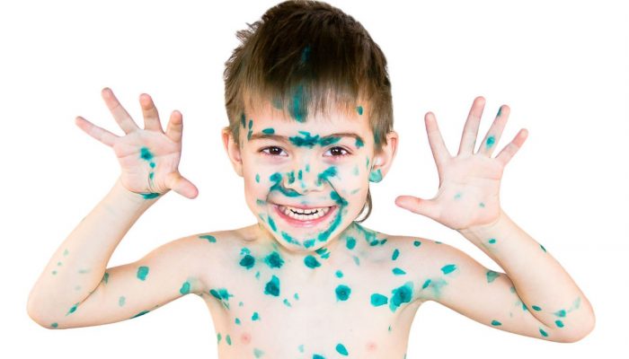Полезные советы, чем можно быстро отмыть зеленку с кожи у взрослых и детей