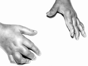 Причины полиартрита пальцев рук