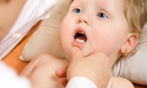 молочница у ребенка во рту до года