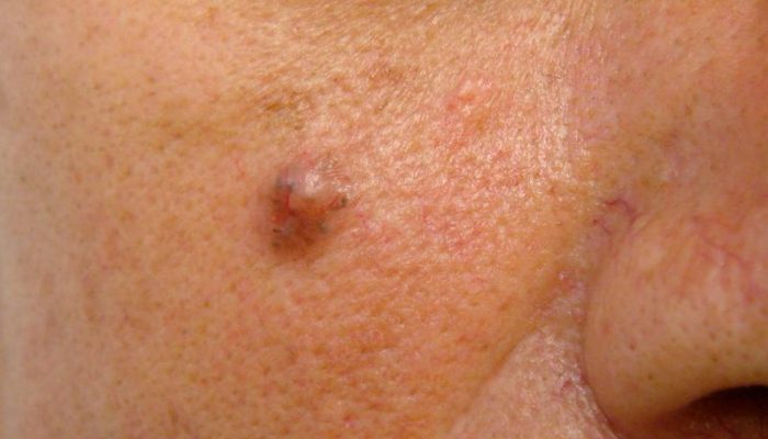 Какие бывают кожные заболевания у человека? Своевременная диагностика болезней кожи
