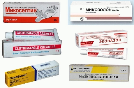 Препараты для лечение кандидоза половых органов (мази, крема и таблетки)