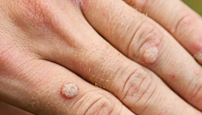 Какие бывают кожные заболевания у человека? Своевременная диагностика болезней кожи