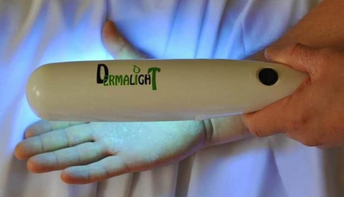 Ультрафиолетовая лампа для лечения псориаза