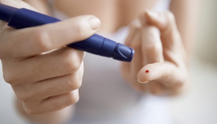 Как лечить зуд при сахарном диабете у женщин и мужчин? Аптечные и народные средства