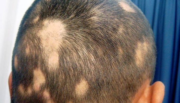 Лечение выпадения волос у животных чего нет