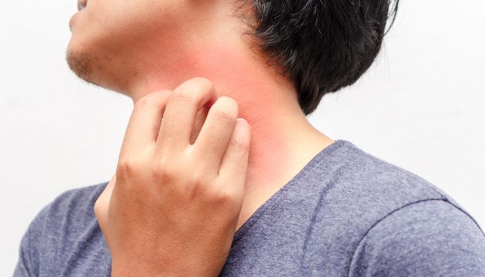 Почему возникает зуд кожи тела? Лечение симптома соответственно причинам
