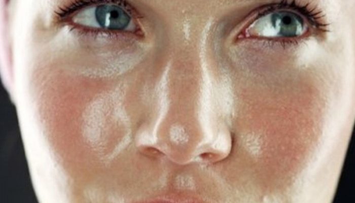 Лучшие рекомендации и способы, как избавиться от жирной кожи на лице
