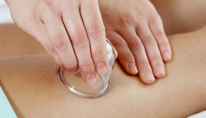 Как делать баночный массаж от целлюлита в домашних условиях? Обзор процедур и техника выполнения