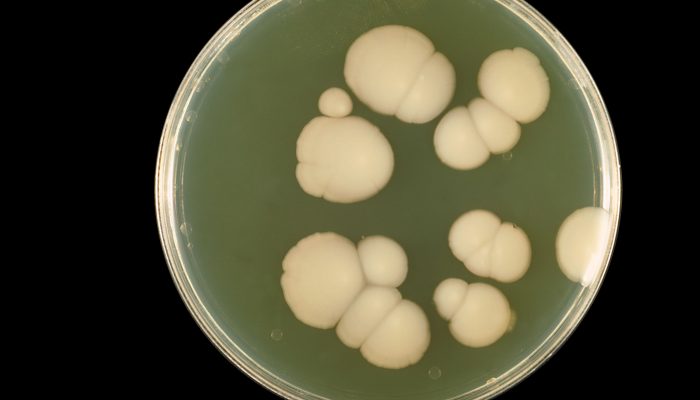 Исследование на патогенный грибок кожи и ногтей