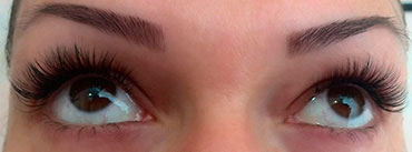 После процедуры наращивания отмечается сильное покраснение глаз