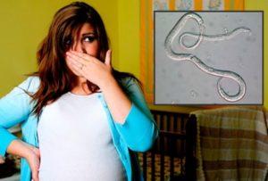 Как вывести глистов при беременности?