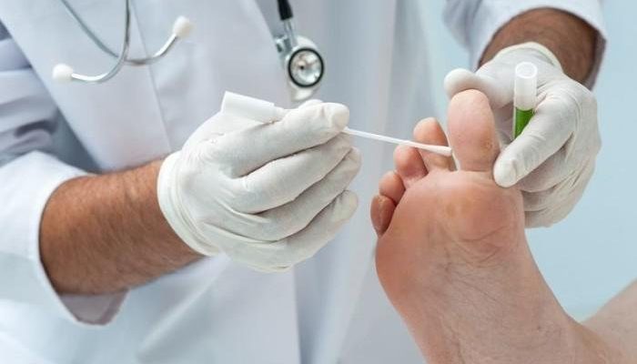 Куда обратиться и какой врач лечит грибок ногтей на ногах и руках?