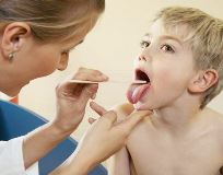 Симптомы, лечение и профилактика стрептококковой инфекции у взрослых и детей