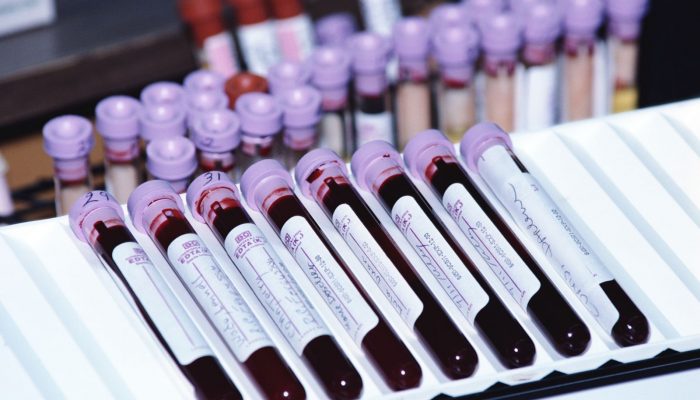 Зачем нужен и как берут анализ на ВПЧ: виды тестов, генотипирование и результаты