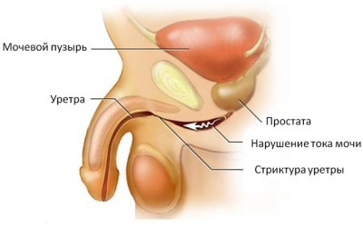 Что такое уретра