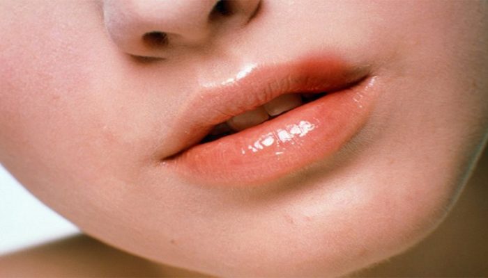 Ожог на губе: чем лечить и что делать?