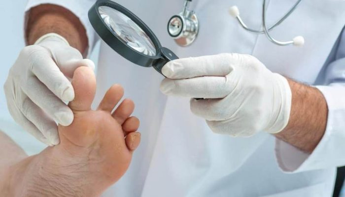 Советы доктора Мясников по диагностике и лечению грибка ногтей
