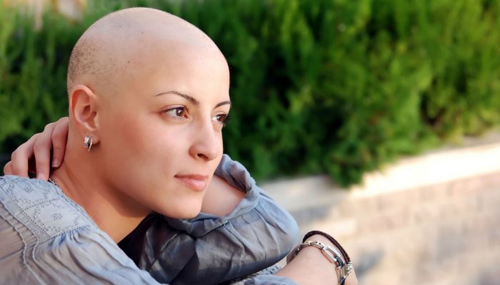 Как ускорить рост волос после химиотерапии?