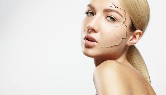 Почему на теле и лице сухая кожа? Эффективные советы для устранения дискомфорта