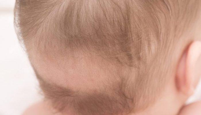 У ребенка сильно выпадают волосы: что делать?