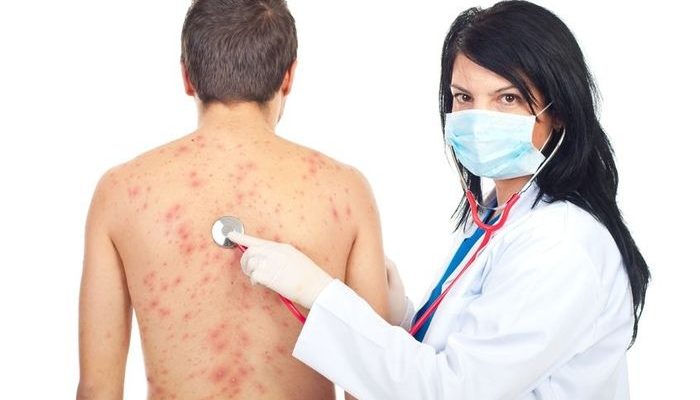 Заразен ли инфекционный дерматит? Причины, симптомы, диагностика и лечение у взрослых, и у детей