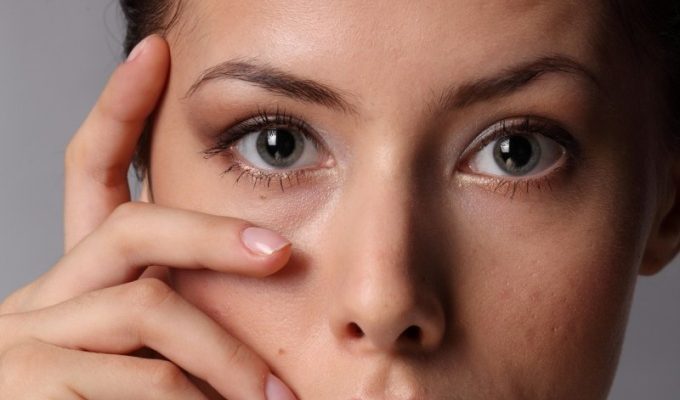 Как лечить мешки под глазами?