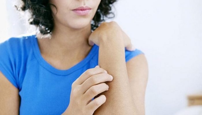 Почему возникает зуд кожи тела? Лечение симптома соответственно причинам