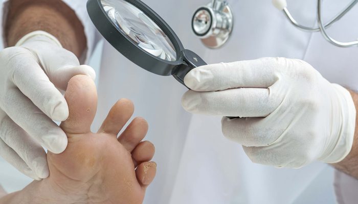 Подробно о лечении грибка ногтей лазером: эффективность, преимущества и противопоказания