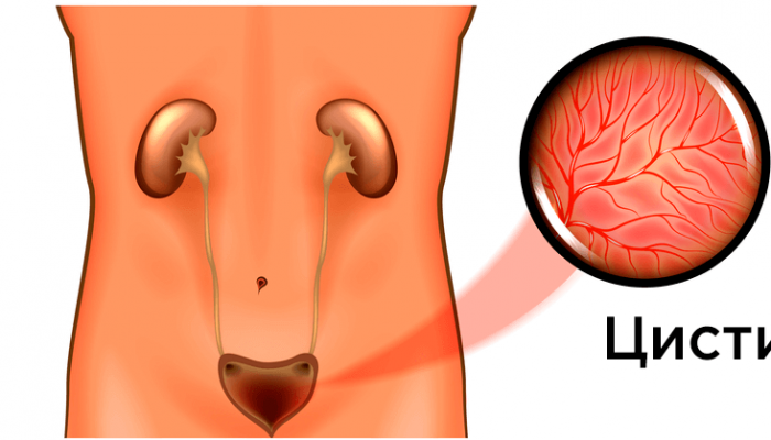 Почему возникает зуд в уретре у мужчин без выделений? Лечение в зависимости от причины проблемы