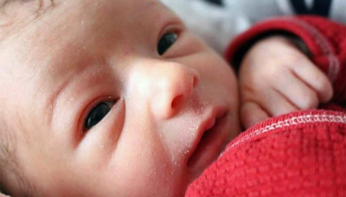 Шелушение кожи новорожденного фото