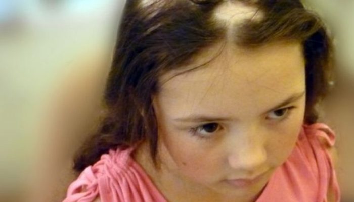 У ребенка сильно выпадают волосы: что делать?